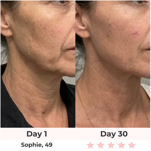 LED Face and neck lifting massager